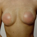 Tapapezones adhesivos push-up